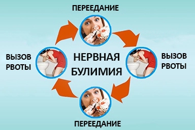 Лечение булимии в Чайковском